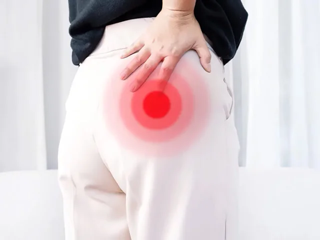 Piriformis Sendromu